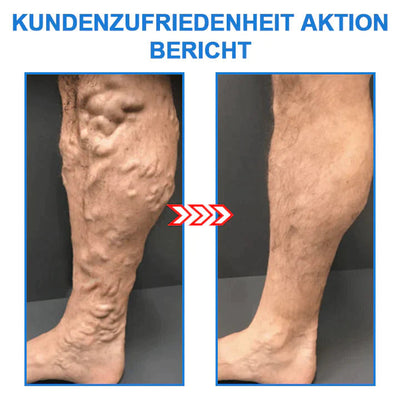 FlexSocken™ Ionic Body Stretch Socken (1+2 frei)