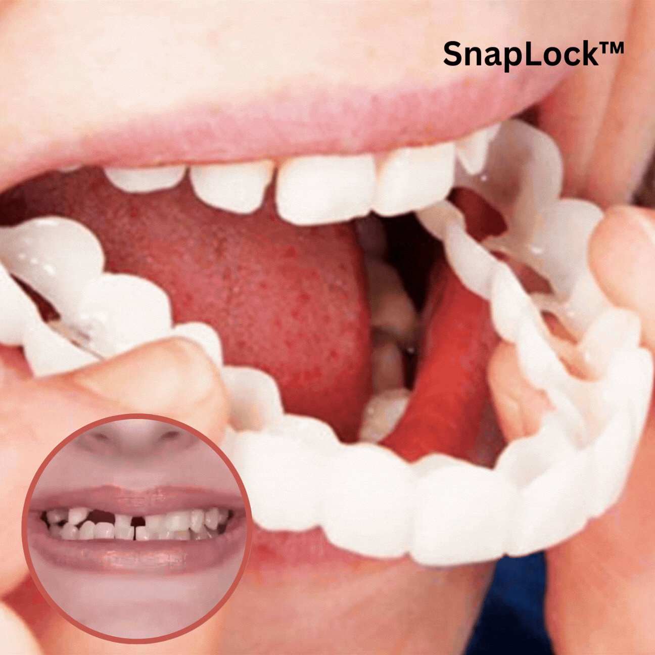 SnapLock™ Zahnersatz zum Einrasten (Nur heute 50% Rabatt)