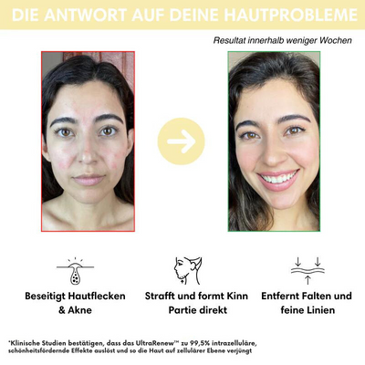 VerjüngungsKur™ Nacken- und Gesichtsmassagegerät