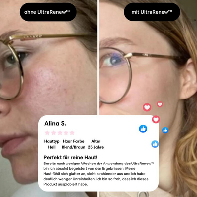 VerjüngungsKur™ Nacken- und Gesichtsmassagegerät