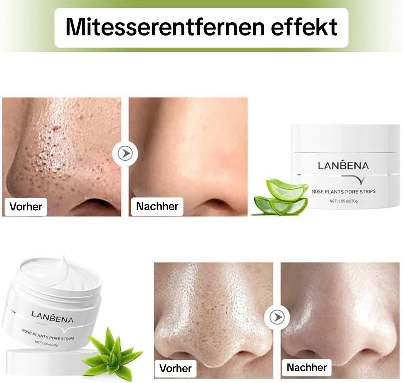 FrischerStreifen™ Porentiefe Reinigung