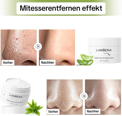 FrischerStreifen™ Porentiefe Reinigung