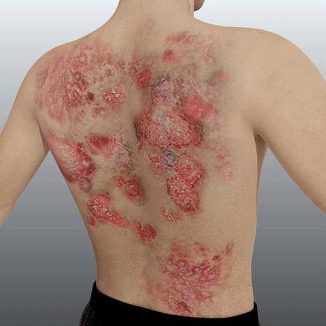 1+1 GRATIS | BeruhigungsSpray™ Lindert trockene Flecken