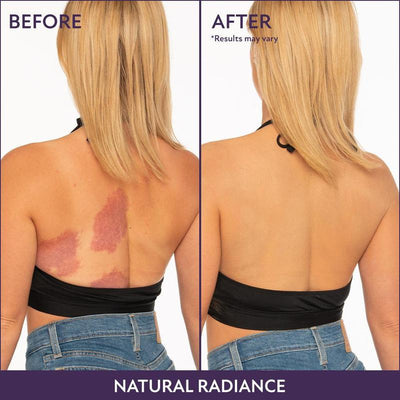 Körper-Perfektionierer | Kaschiert Narben, Venen & Flecken | Wasserfest & 24h Halt