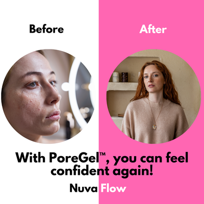 1+1 FREE | PorePerfekt™ Minimiert Poren sofort