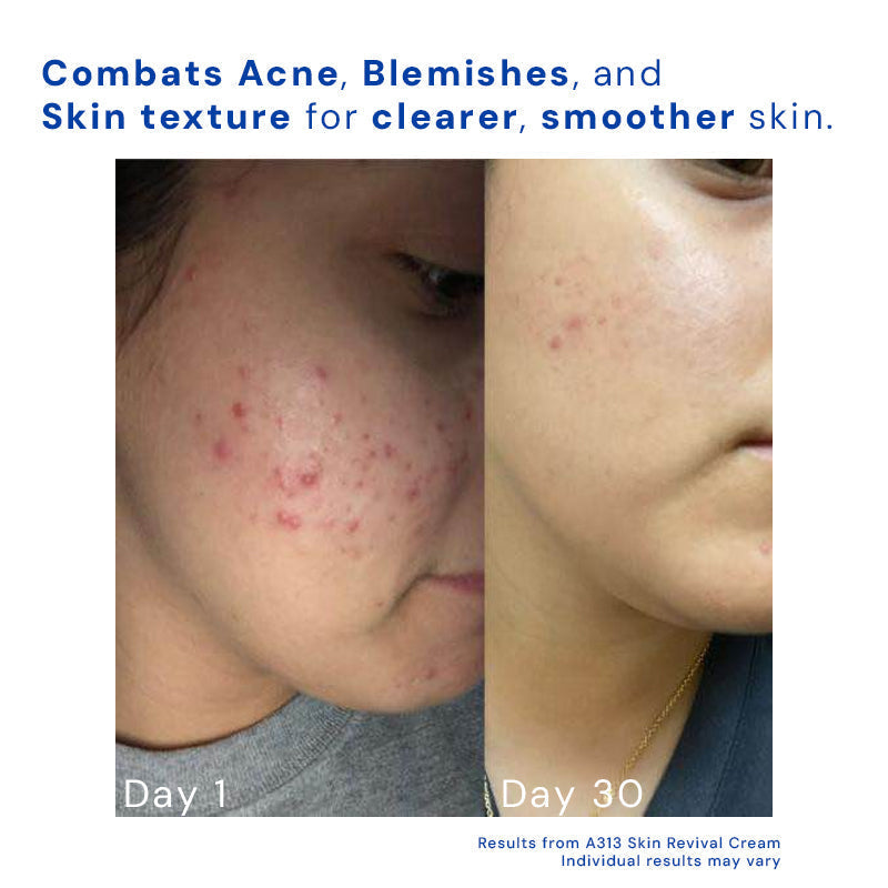 Retinol Gesichtscreme | Vitamin A Anti-Aging Nachtcreme | Glättet Falten & Beugt Akne vor | Dermatologisch getestet