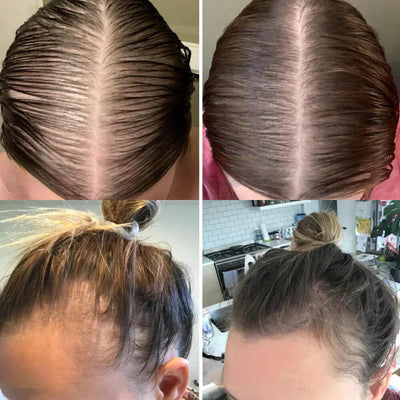 VitalesWachstum™ Haarwuchs-Öl