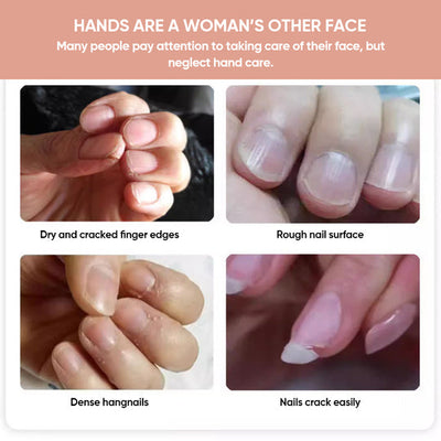 NägelNähren™ Essentielle Nageltherapie