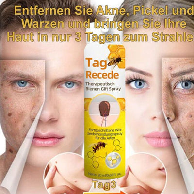 1+1 GRATIS | DermiClear™ - Bienenharzspray zur Entfernung von Warzen und Muttermalen