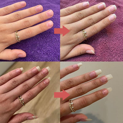 NägelNähren™ Essentielle Nageltherapie
