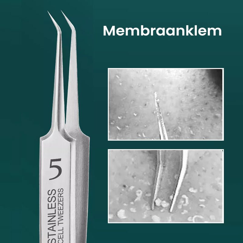 HautGreif™ Zielgerichtete Pickelentfernung
