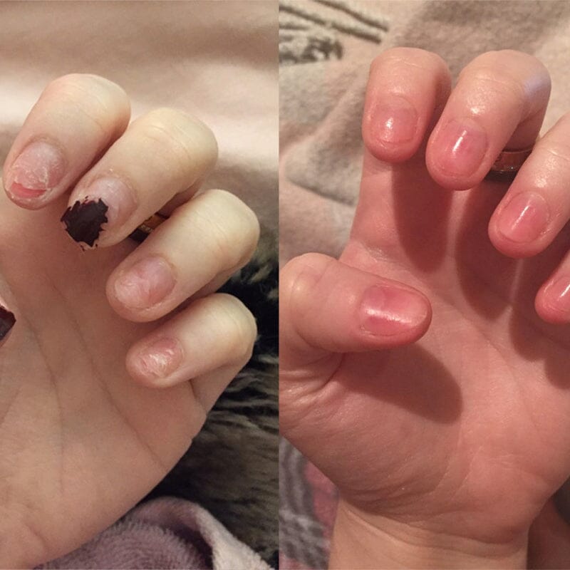 NagelElixier™ Revitalisierende Nagelbehandlung