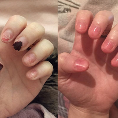NagelElixier™ Revitalisierende Nagelbehandlung