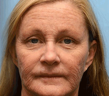 Anti-Falten Creme | Straffende Gesichtscreme mit Feuchtigkeit & Glow Effekt | Glättet Falten & Verleiht Jugendliche Haut