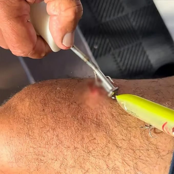 2+1 Gratis | Angel Hakenlöser Werkzeug | Sicher & Schnell | Rutschfester Griff | Präzise Abgewinkelte Spitze