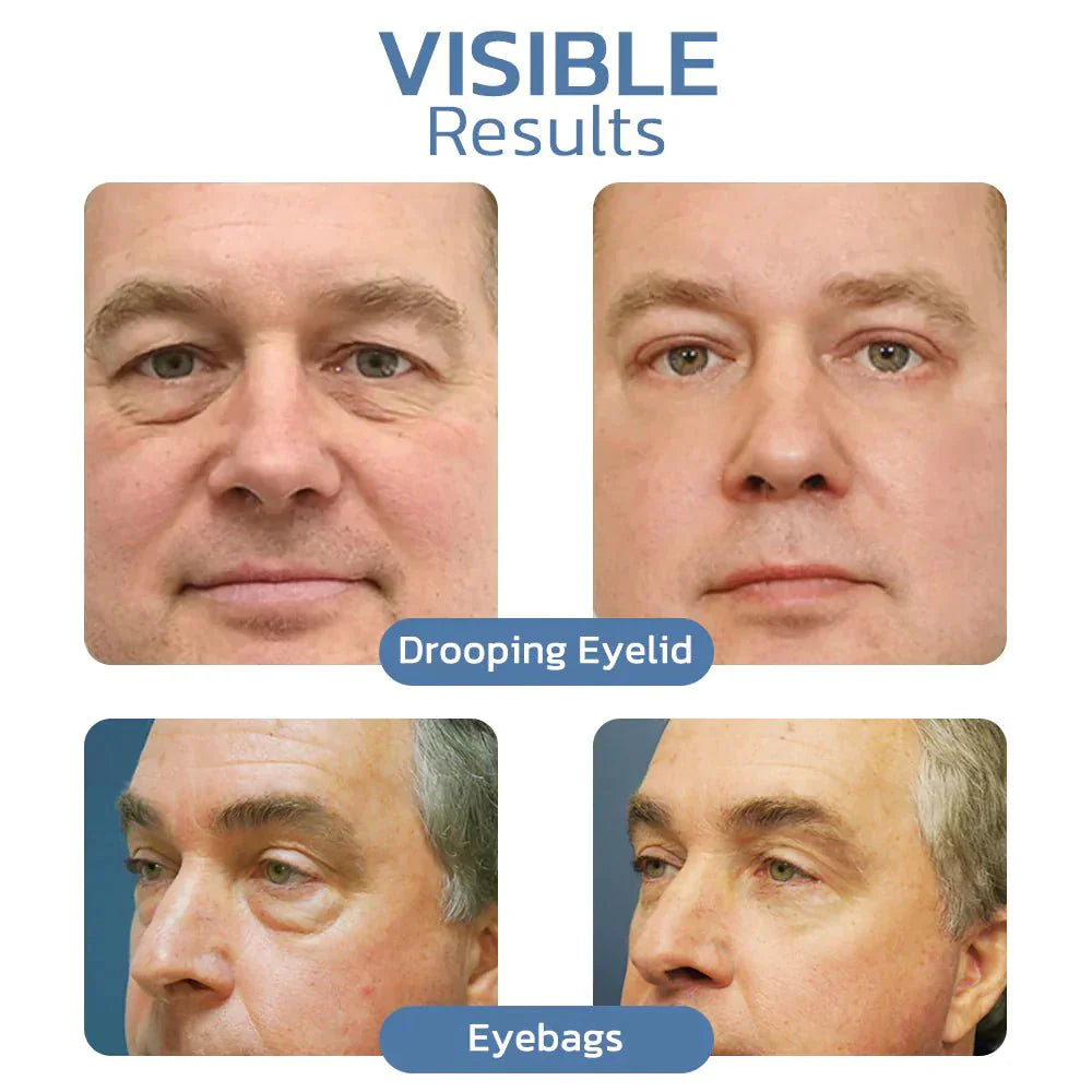 EyeRefresh™ Peptid Straffendes Augengel