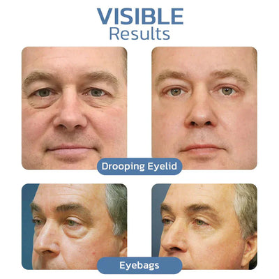 EyeRefresh™ Peptid Straffendes Augengel