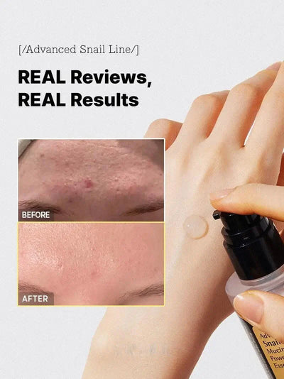 Gesichtsserum mit Schneckenschleim | 96,3 % Snail Mucin | Hautregeneration & Feuchtigkeit